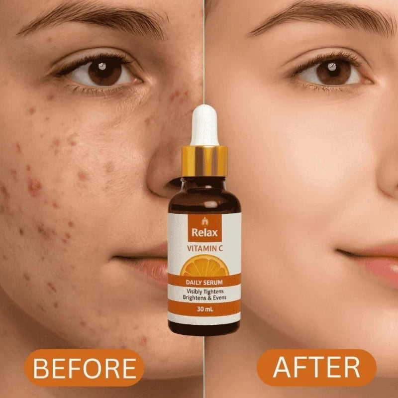 Relax Vitamin C Daily Serum - 30ml | Brightening & Anti-Aging Facial Serum