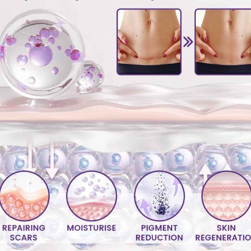 Timilk Regenscar Stem Cell Scar Gel 20g - Triple Action Formula For Old