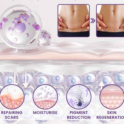 Timilk Regenscar Stem Cell Scar Gel 20g - Triple Action Formula For Old